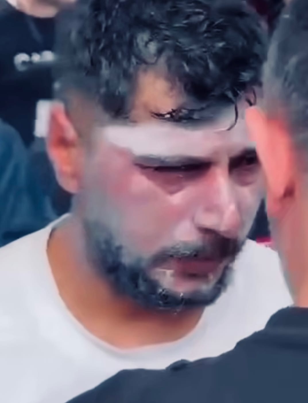 Vazhdon dhuna policore ne Tirane  Lendohet artisti Bledar Cakalli 
