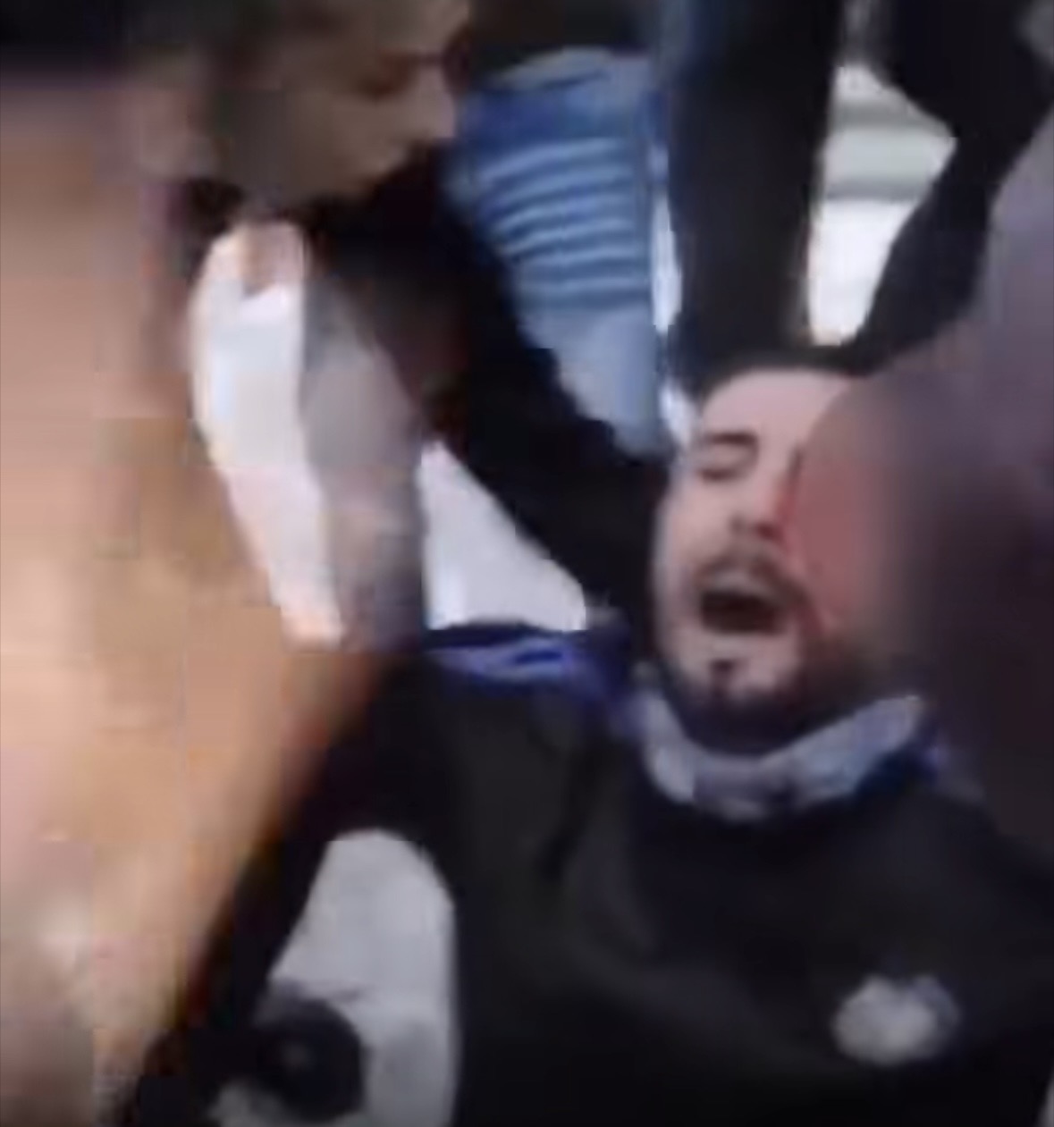I RIU PLAGOSET NË SY GJATË PROTESTËS NË TIRANË  PAMJET SHKAKTOJNË SHQETËSIM