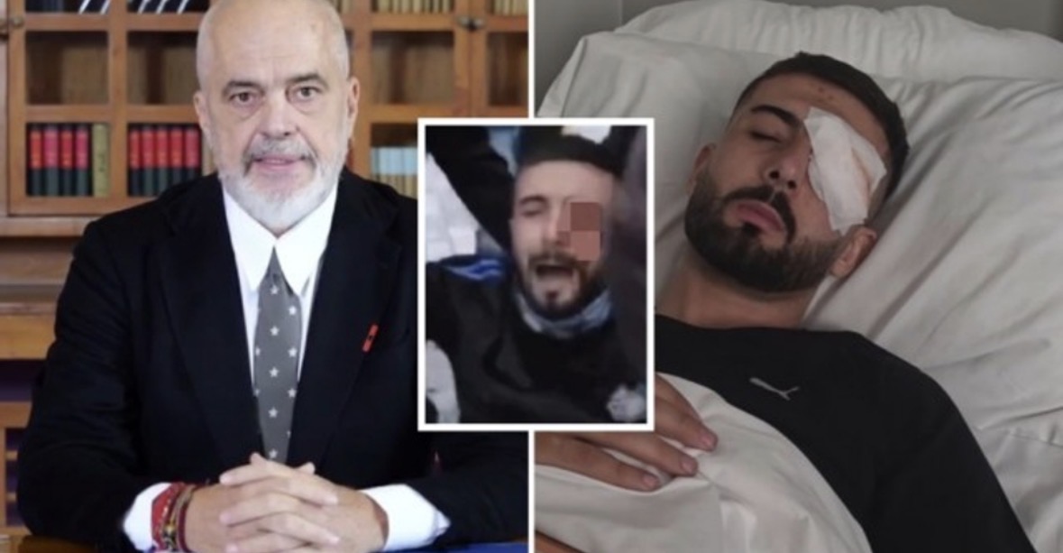MOTRA E ERJON VISHKULLIT PËRGENJESHTRON RAMËN   JANË TË GJITHA MASHTRIME  NË ITALI E KA DËRGUAR FAMILJA  JO SHTETI 